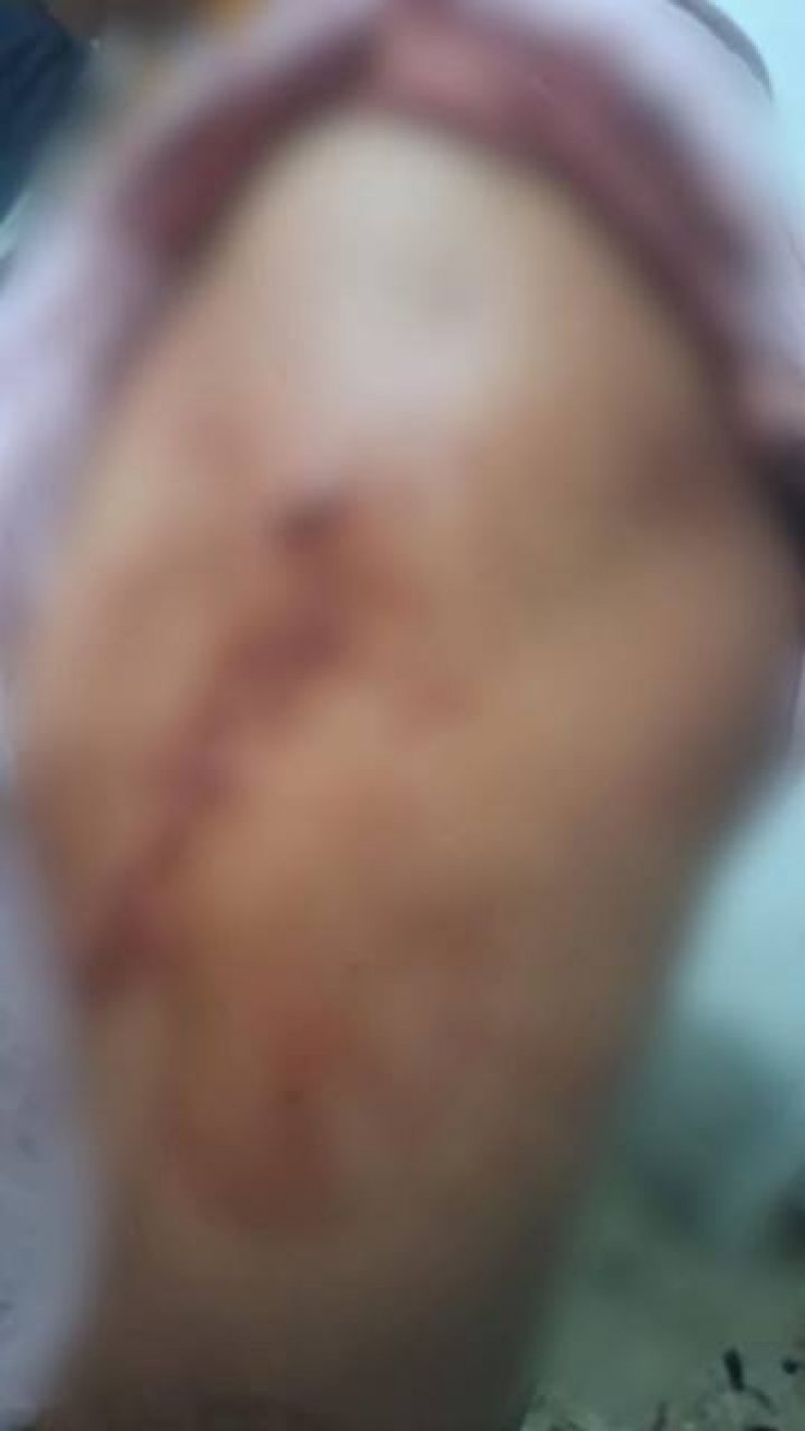 Polic&iacute;a Municipal atiende ri&ntilde;a con arma blanca que deja dos lesionados